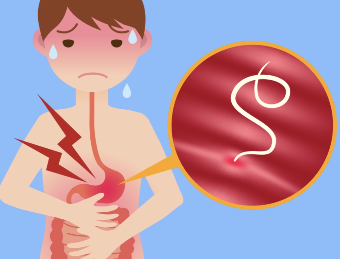 Scopri di più sull'articolo Spesso la chiave di cura per molti disturbi è nella terapia dei parassiti intestinali